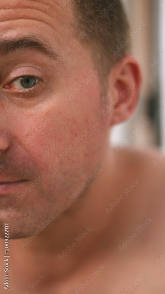 Naklejka premium Vertical photo Closeup facial portrait, Intimate male skin examination, Focus on facial features, skin texture, Closeup view capturing male facial details with emphasis on skin, emotional expression