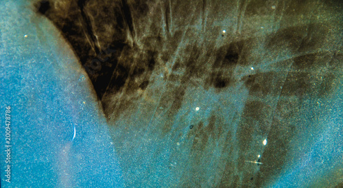 Abstract blue grunge texture with xray anatomy elements and distressed overlay. Medical background with film scratches, dust and vintage noise effect.