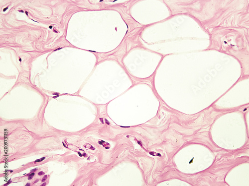 Bild auf Leinwand Under an optical microscope, the adipocytes appear as large vacuoles with flattened nuclei located at the cell edge