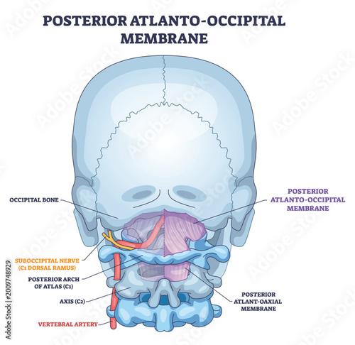 Posterior atlanto-occipital membrane shown stabilizing the craniovertebral junction, highlighting occipital bone, atlas C1, and vertebral artery. Outline diagram