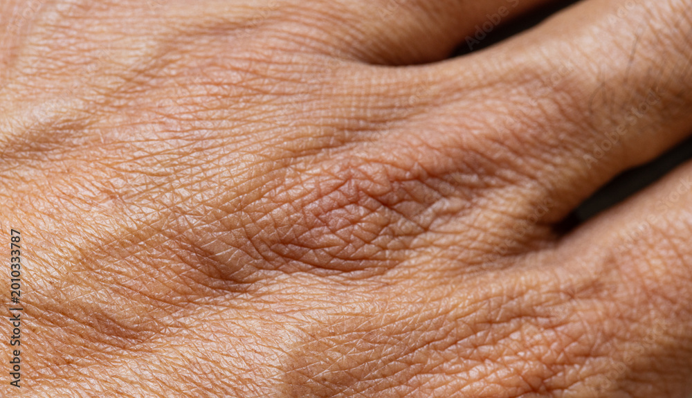 Naklejka premium Extreme Close-up of Human Skin Texture with Fine Lines and Wrinkles,Macro,A detailed macro shot capturing the intricate texture, pores, and natural aging patterns of human skin on the hand.