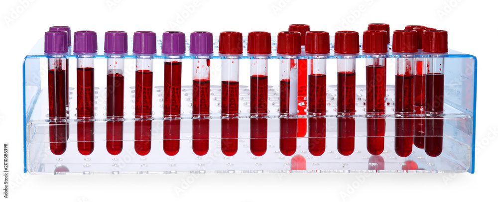 Obraz premium Many test tubes with blood samples in rack isolated on white