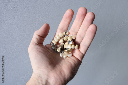 A person holds many ceramic, zirconium, and metal-ceramic dentures in his hand.