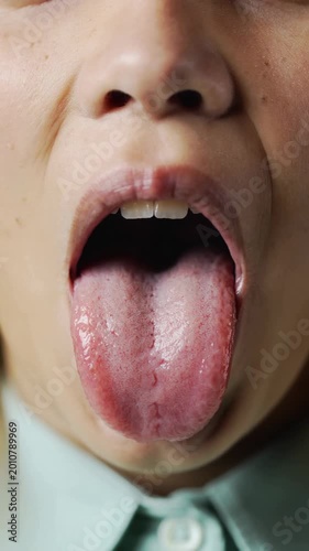 Young woman showing tongue and teeth for medical examination extreme close up