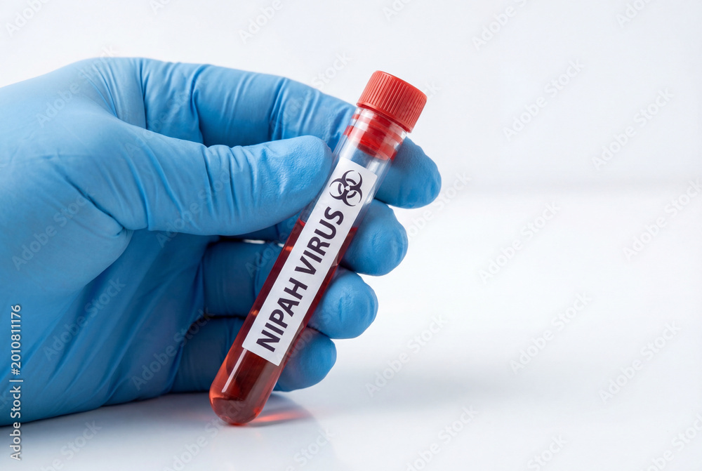Fototapeta premium Gloved hand holding test tube with blood sample labeled nipah virus