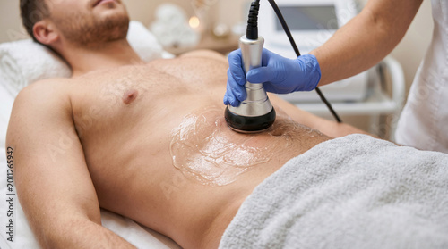 Close-up of a young man receiving ultrasonic cavitation treatment on his abdomen at a spa clinic, non-invasive body contouring and fat reduction procedure for male figure correction