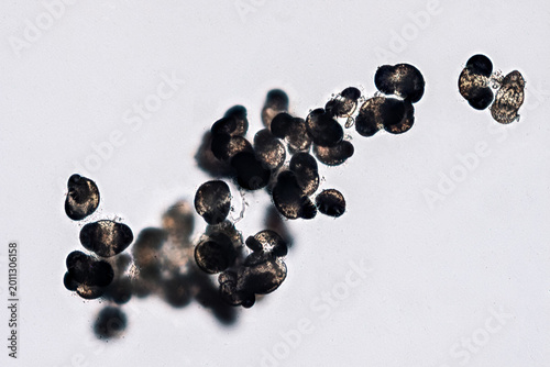 Foto Pollen grains under microscope causing seasonal allergies - optical microscope 2