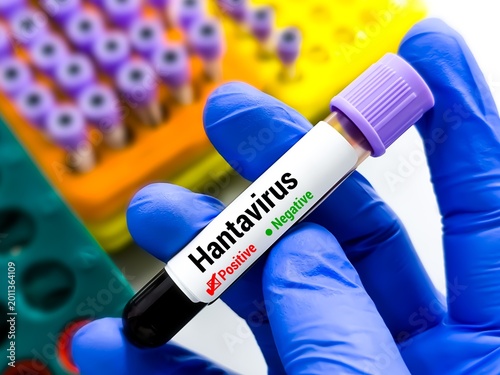 Blood sample for Hantavirus test, Orthohantavirus