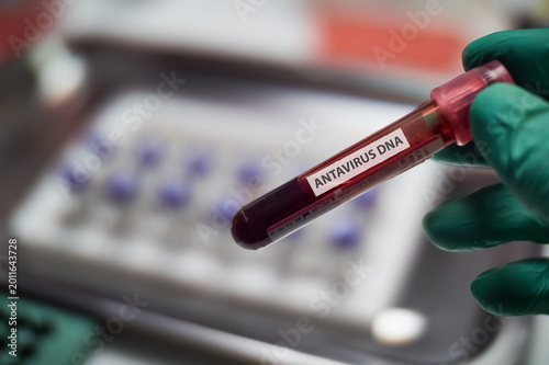 An epidemiologist holds a vial containing a sample for antiviral virus analysis in a laboratory