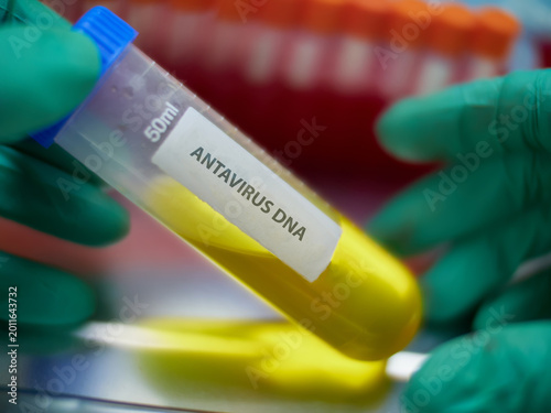 An epidemiologist holds a vial containing a sample for antiviral virus analysis in a laboratory