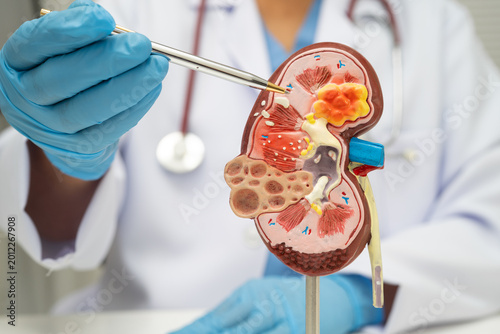 Chronic kidney disease, doctor with model for treatment urinary system, urology, Estimated glomerular filtration rate eGFR.