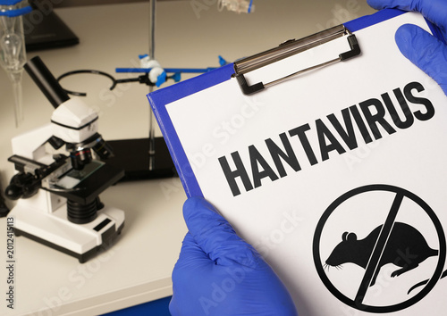 Hantavirus disease, rodent borne viral infection, public health risk, epidemiology, virus transmission through contaminated environments, respiratory illness, medical research and outbreak awareness