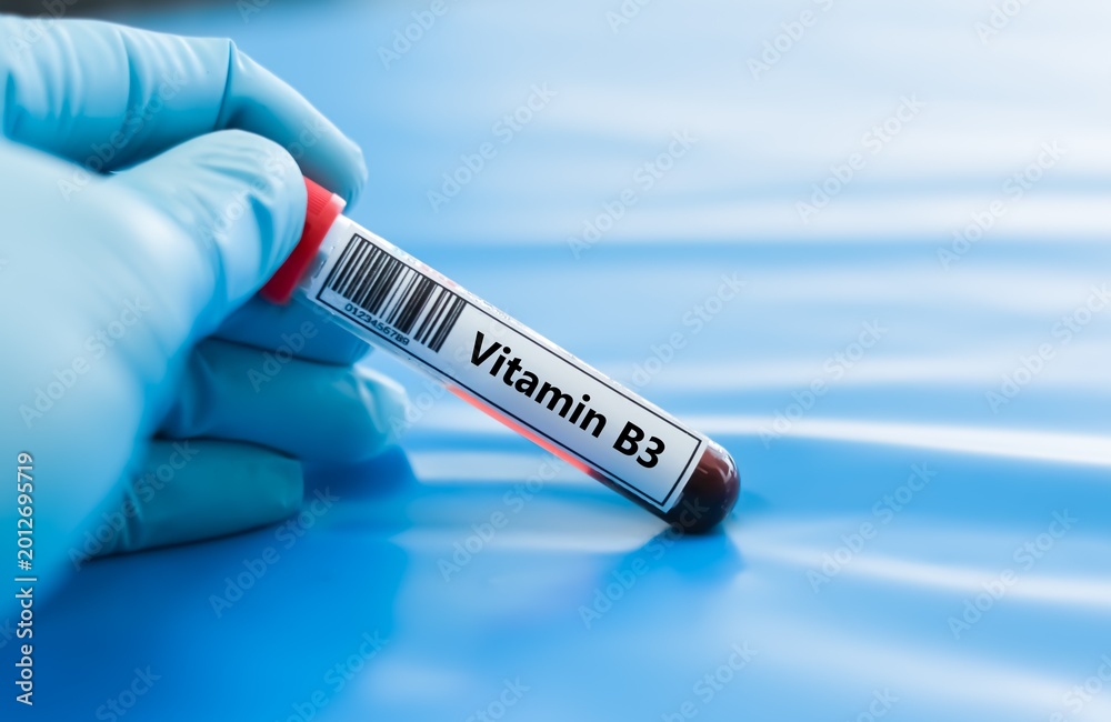 Fototapeta premium Blood sample tube for vitamin B3 test analysis.