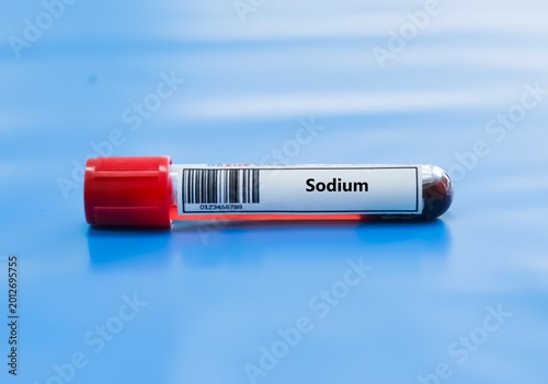 Obraz na płótnie Blood sample tube for sodium test analysis.