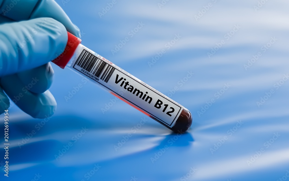 Obraz premium Blood sample tube for vitamin B12 test analysis.