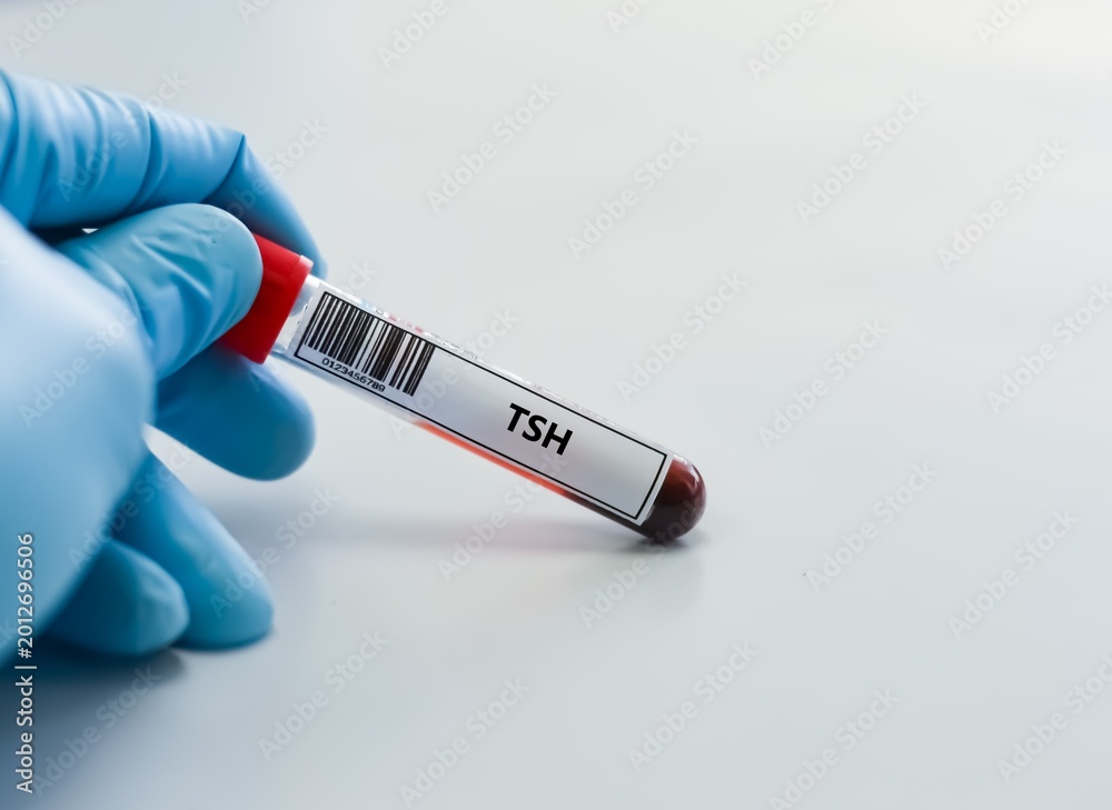 Fototapeta premium Blood sample tube for TSH test analysis.