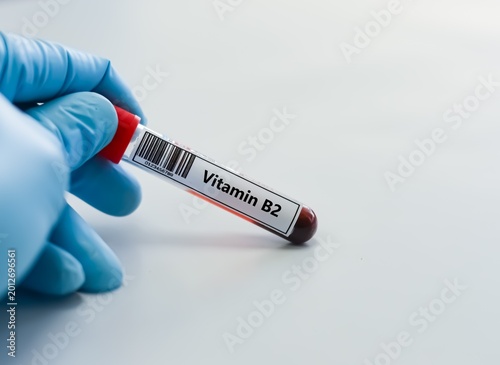 Photos Blood sample tube for vitamin B2 test analysis.