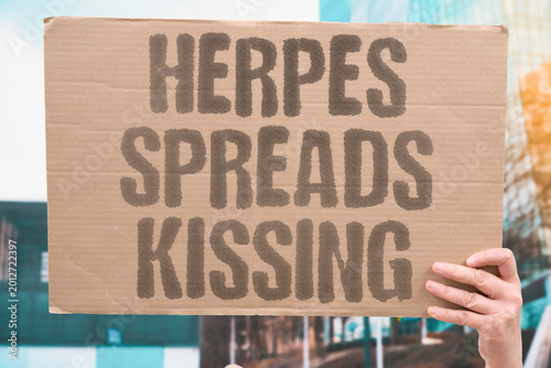 Photos "Herpes Spreads Kissing" Oral herpes transmits easily through kissing even without visible active cold sores
