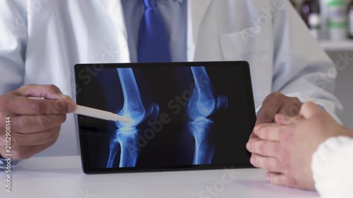 Doctor and tablet for x ray with knee, scan or osteoporosis with point at hospital. People, application and ux for medical consultation for arthritis, feedback or report for wellness at clinic office