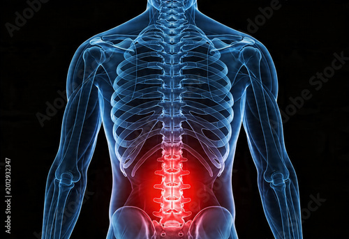 Adult person anatomy with inflamed lower back pain, illustrating health issues like sciatica nerve ache. Medical illustration of bvoday inflammation causing discomfort. 