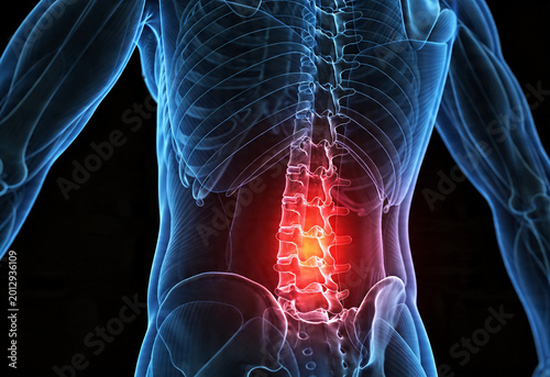 Digital illustration of human anatomy showing lower back pain inflammation and ache in adult person's spine.