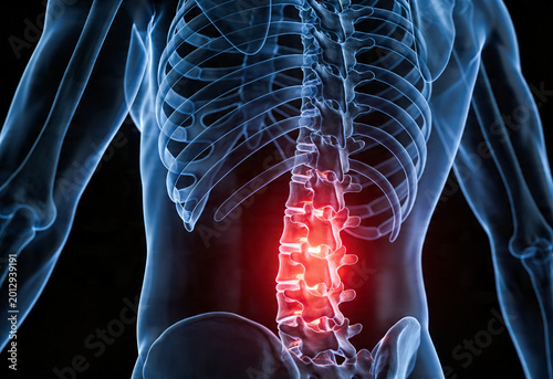 Human anatomy of adult person with lower back pain inflamed nerve ache health inflammation sciatica bvoday medical condition young caucasian.