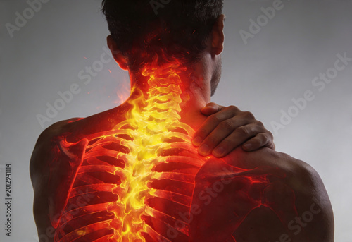 Man experiencing severe neck and upper back pain with fiery inflammation along spine anatomy medical.