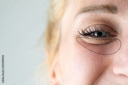 Canvastavla Woman's eye with drawn under-eye bags indicating aging