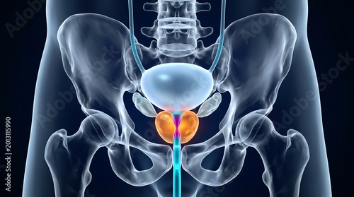 Benign Prostatic Enlargement Visualization in Male Pelvic Anatomy Showing Prostate Gland Compression of Urethra, Bladder Neck Narrowing and Lumbar Spine Skeleton Render
