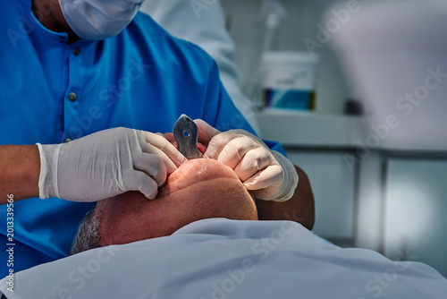 Bild auf Leinwand Dentist in blue scrubs takes dental impression of male patient lying on dental chair in modern clinic with dental tools and equipment visible