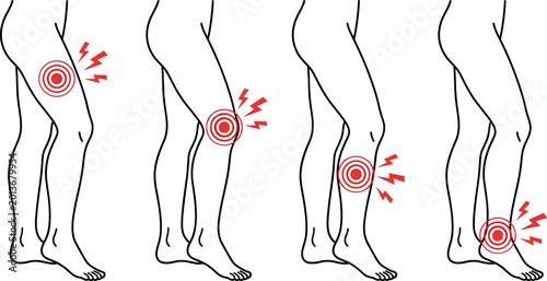 Canvastavla Set of Body Pain Icons Depicting Leg and Knee Pain with Red Circles and Lightnin