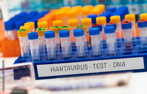 Several hantavirus positive research vials in a laboratory, conceptual image