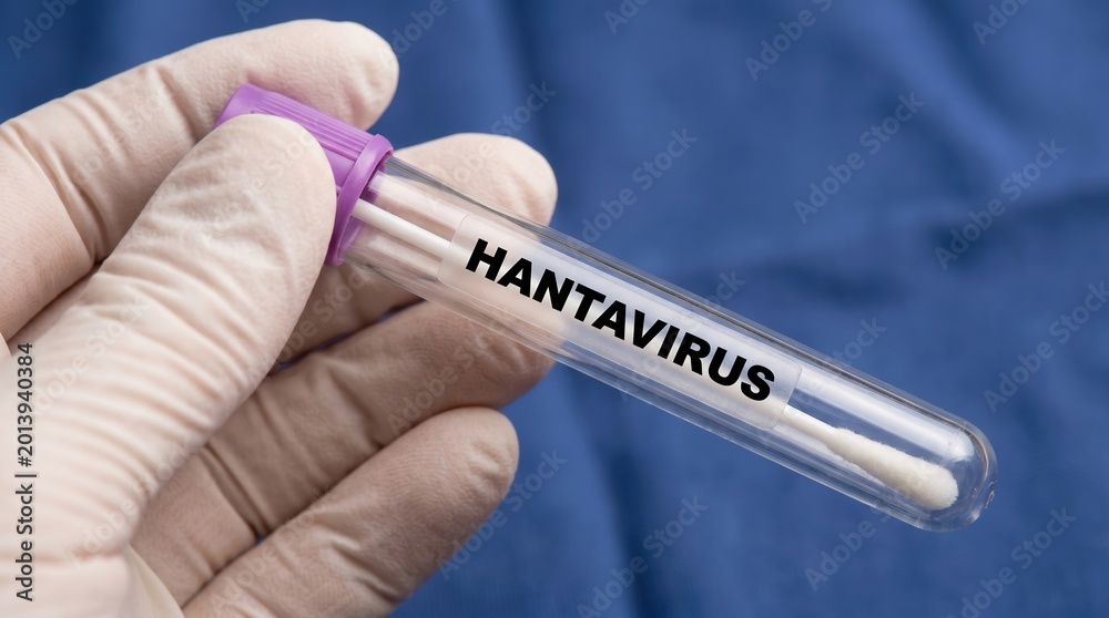 Obraz premium Gloved Hand Holding Hantavirus Test Tube for Medical Laboratory Diagnosis