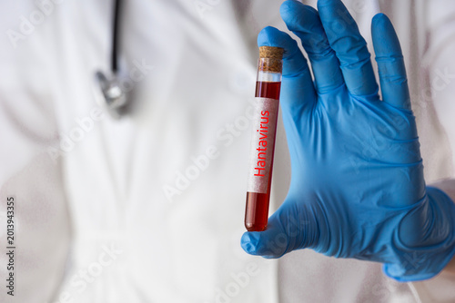 scientist holding test tube with hantavirus blood sample closeup medical worker in protective gloves and mask doing laboratory research concept of virus diagnostic and quarantine