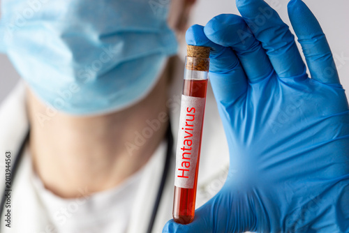 scientist holding test tube with hantavirus blood sample closeup medical worker in protective gloves and mask doing laboratory research concept of virus diagnostic and quarantine