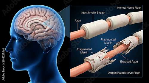 Human brain and nerve fiber anatomy with myelination comparison