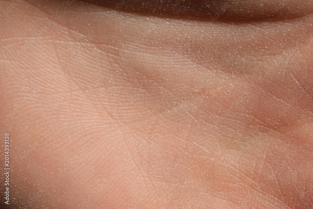 Fototapeta premium Texture of dry skin as background, closeup