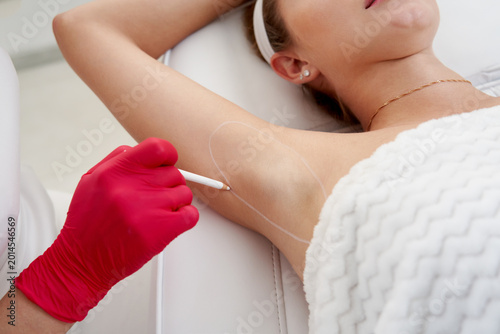 Canvastavla Doctor makes injections of botulinum toxin in the underarm area against hyperhidrosis in beauty salon