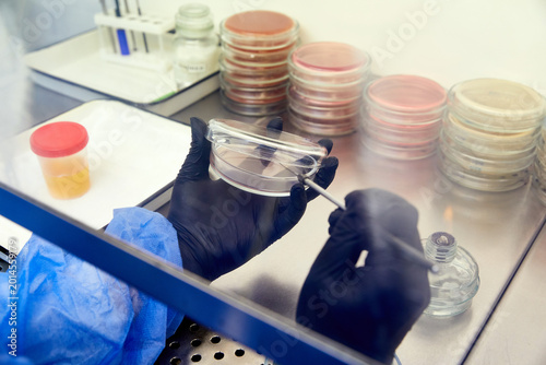 Canvas Print medical technologist doing urine test in medical laboratory wearing protective u