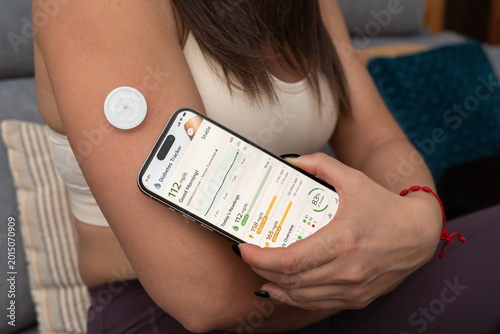 Fotografie Continuous glucose monitoring using smartphone for diabetes management