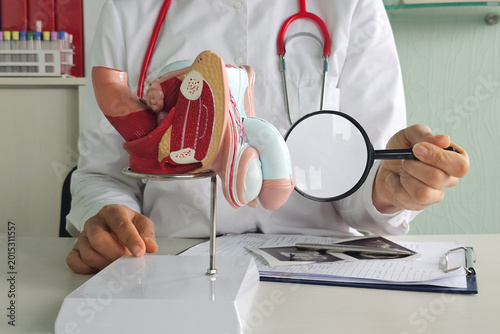 Quadro su tela Doctors counseling patients with prostate cancer and using a penis model to show