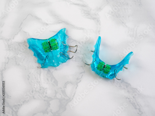 Blue removable orthodontic appliance set for upper and lower jaw with expansion screw key, bite correction and pediatric dentistry.