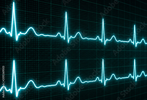 heart beat cardiogram