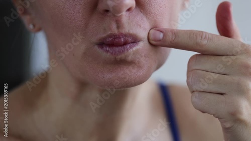 Unwanted facial hair. Woman has excessive hair on her face. Closeup. 4K.