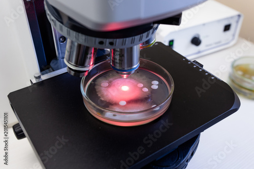 Photos Studying the action of antibiotics on discs under a microscope, researching the effect of antibiotics on bacteria in the laboratory