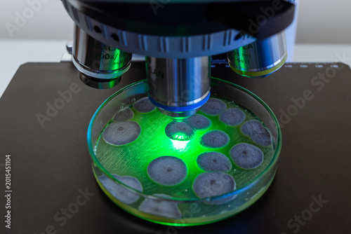Fotografia Allergens caused by the growth of mold fungi and the dispersal of spores are studied in the laboratory under a microscope