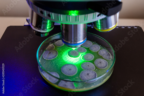 Quadro em tela Studying dangerous grey mold on Petri dishes under magnified microscope objectives