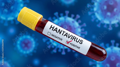 Laboratory test tube filled with blood showing positive hantavirus diagnosis on blue background with abstract virus particles illustrating serious health threats