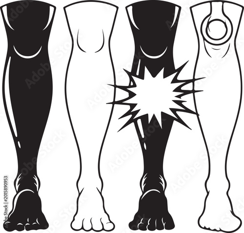Tableau sur toile Leg injury anatomy icons set with knee pain and shin impact symbols for medical diagnosis