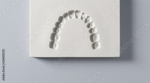White dental stone bite mark cast showing curved tooth impression pattern forensic odontology evidence overhead macro photography grey background.